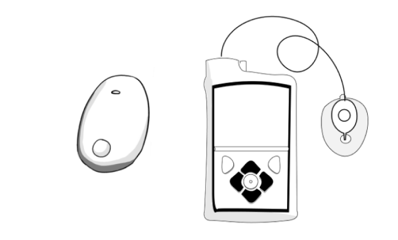 Eversense Medtronic 1