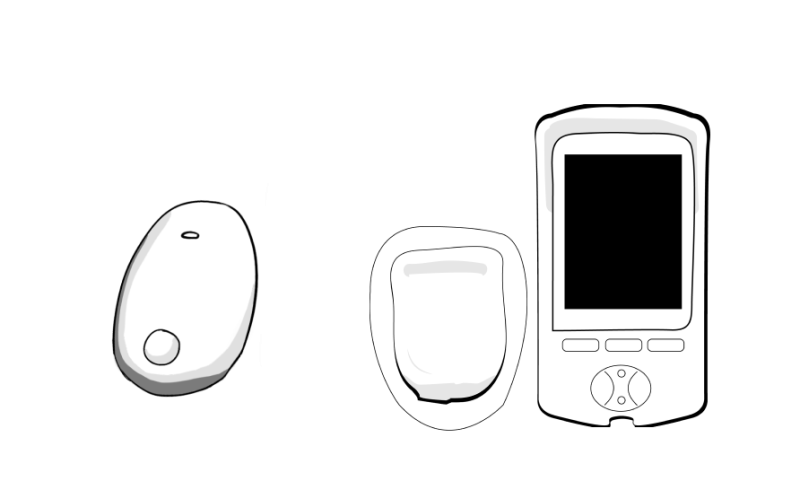 Eversense Omnipod v3