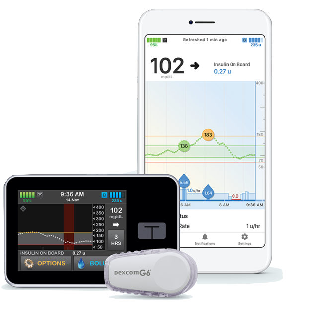 Imagen del dispositivo tándem Bolus móvil copia v2