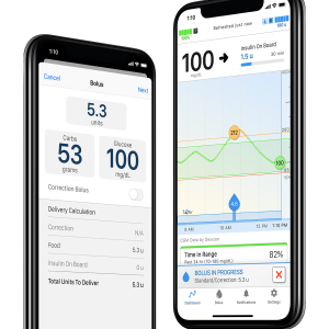 Tandem t:slim X2 : Contrôleur